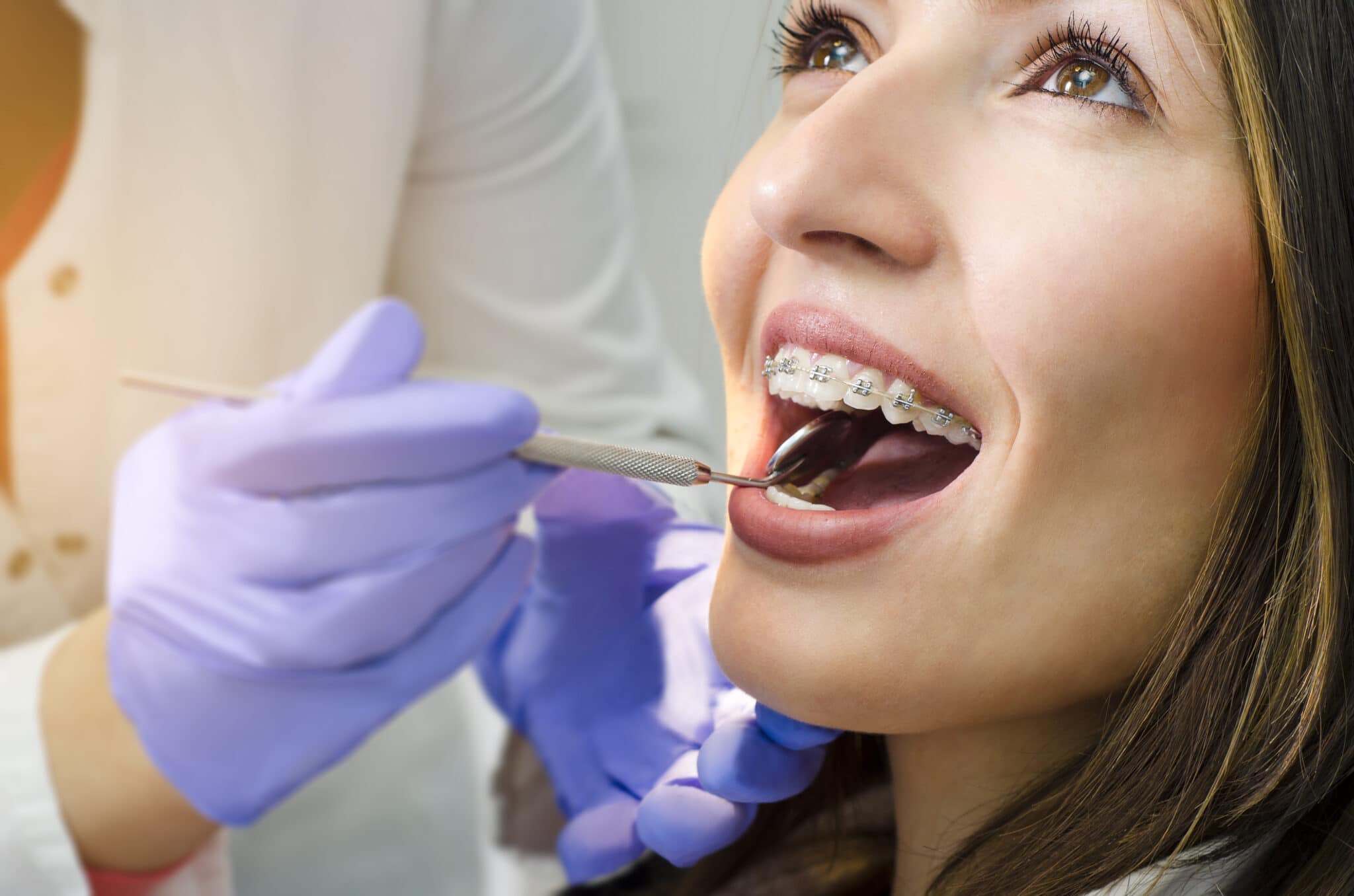Fixed Braces - Orthokind York